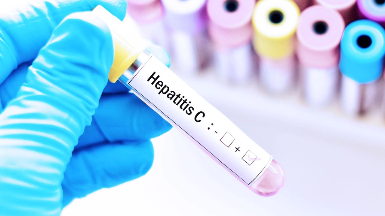 Día Internacional de la Hepatitis C