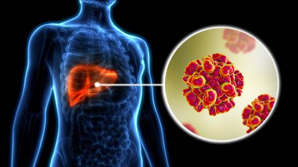 Hepatitis B y C continúan expandiéndose en el país