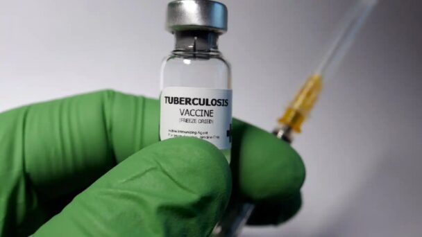 Desarrollan un mecanismo para hacer más eficaz la vacuna contra la tuberculosis